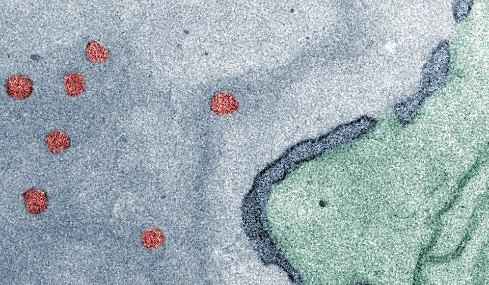 Um in den Zellkern (grau) zu gelangen, müssen die Polymersomen (rot) die Kernmembran (dunkelblau) durch die Kernporenporenkomplexe (Lücken in der Kernmembran) passieren. (Bild: Christina Zelmer, Universität Basel; Evi Bieler, Swiss Nanoscience Institute)