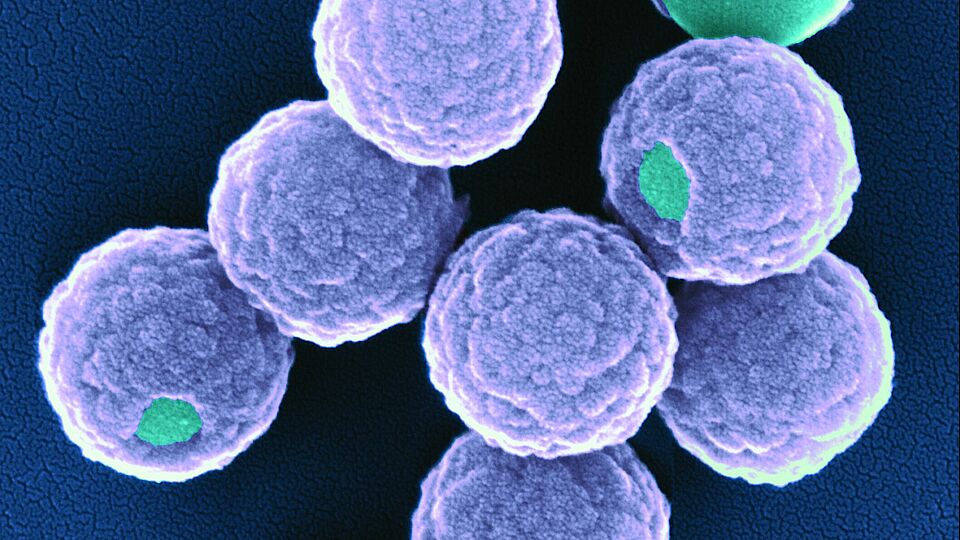 Immobilisierte Enzyme auf einem Nanopartikel durch organische Kieselsäureverbindungen geschützt (Bild: M.R. Correro, M. El Idriss)