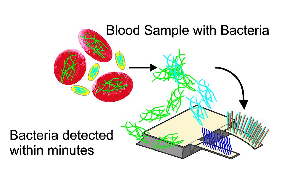 Mit einem nanomechanischen Sensor lassen sich wenige Bakterien in einer Blutprobe nachweisen. (Bild: Departement Physik, Universität Basel)