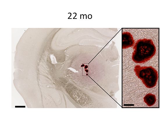 Im Gehirn von alten Mäusen konnte Daniel Verkalkungen nachweisen (Bild: Daniel Stähli).