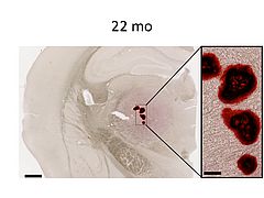 Im Gehirn von alten Mäusen konnte Daniel Verkalkungen nachweisen (Bild: Daniel Stähli).