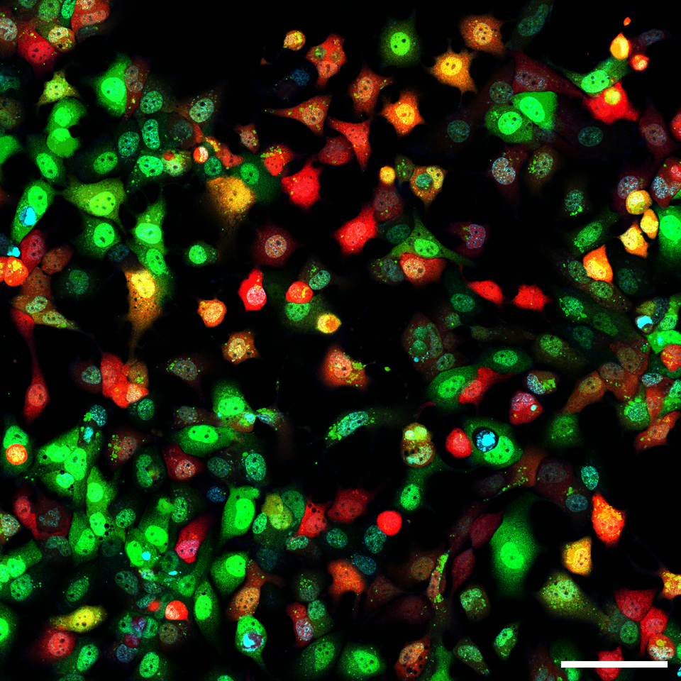 Lipid-Nanopartikel in transgenen Zellen