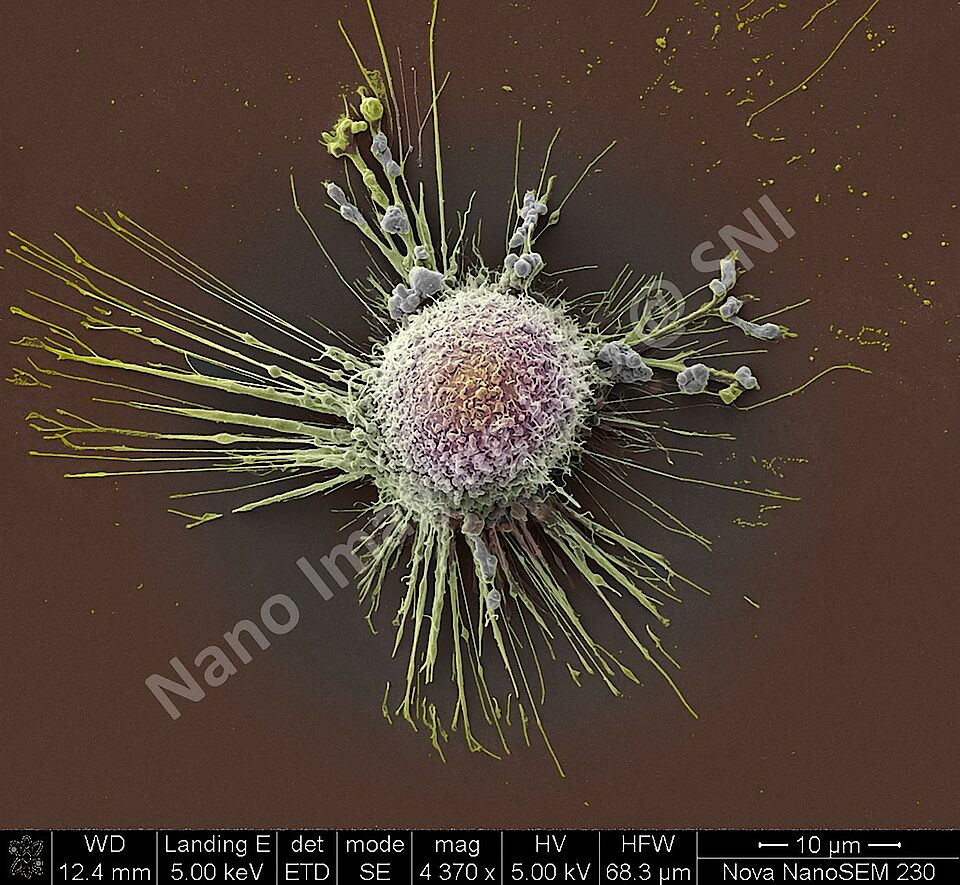Hela cancer cells