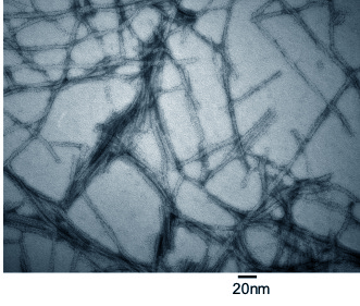 Transmission electron micrograph of the peptide hydrogel.