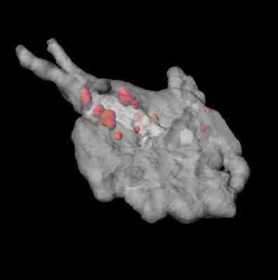 Makrophagen (weiss, transparent, markiert ist das Aktin-Zytoskelett) mit intrazellulaeren Eisenplatin-Nanopartikeln (rot, fluoreszenzmarkierte Huelle)