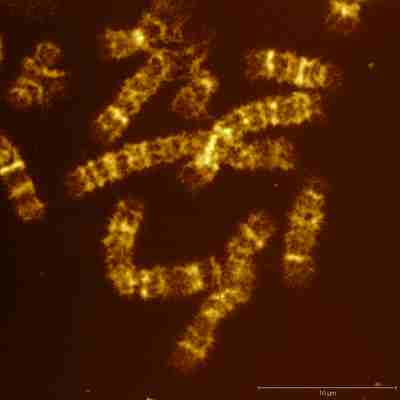 Individual female chromosomes (from 6th to 13th chromosomes) isolated from blood and imaged with the AFM